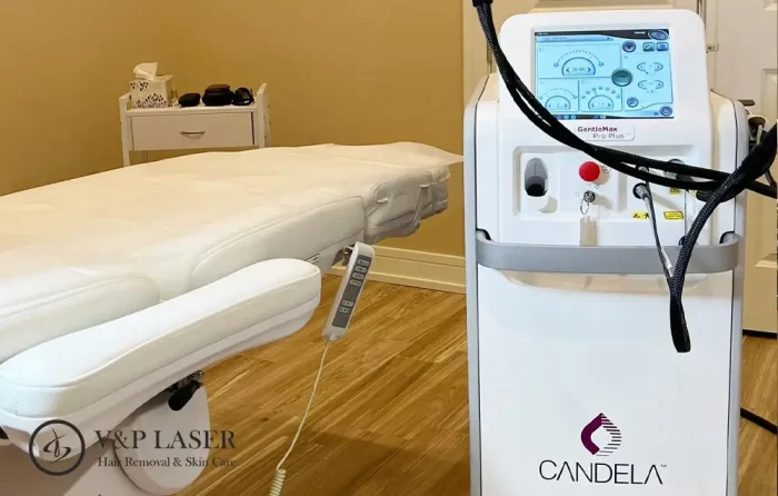 Brazilian laser hair removal