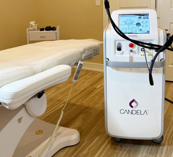 Candela laser hair removal