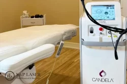 laser hair removal chicago