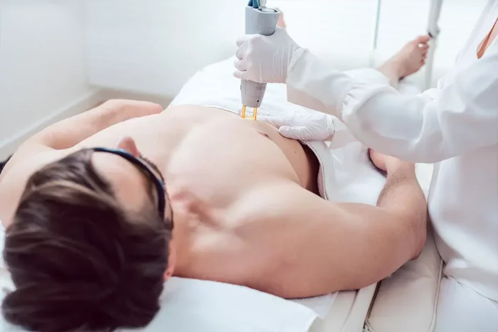 Chest laser hair removal treatment in Chicago, IL at V&P