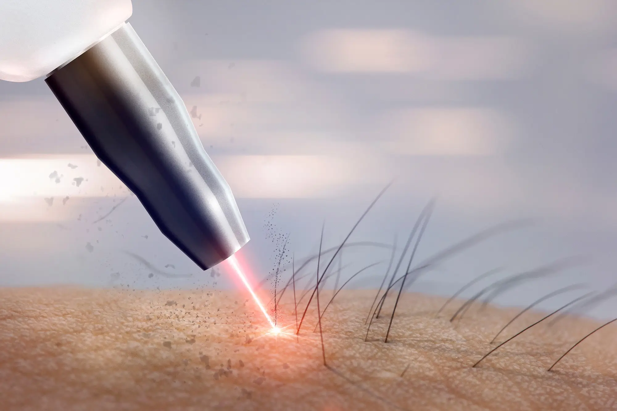 How to Prepare for Scalp Laser Hair Removal