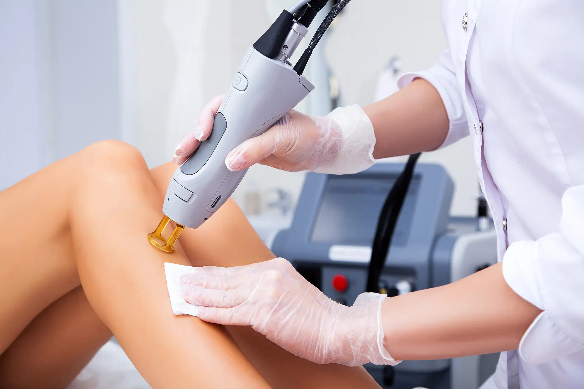 Laser Hair Removal on Legs