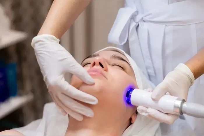 Lip laser hair removal
