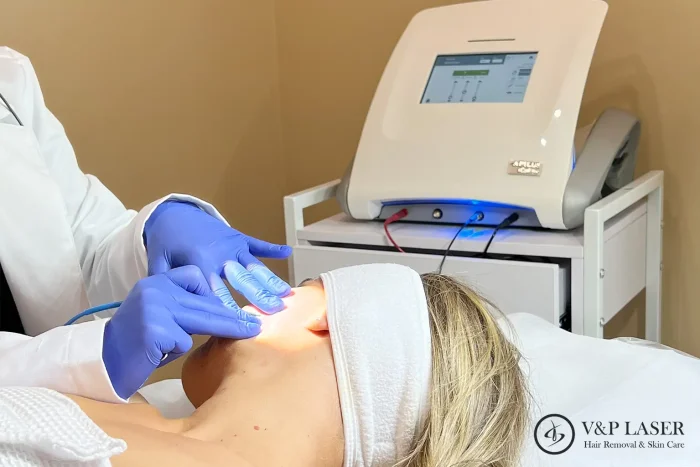 MTF Electrolysis hair removal